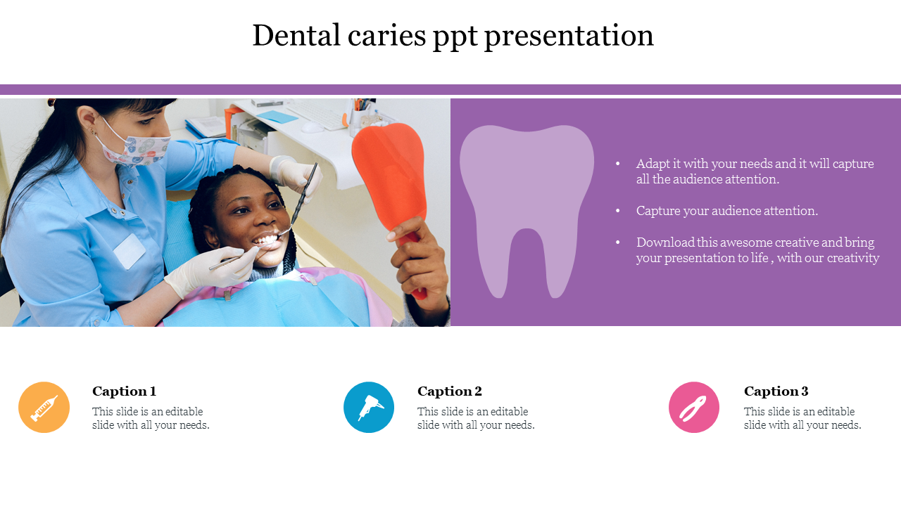 Dental caries ppt presentation 